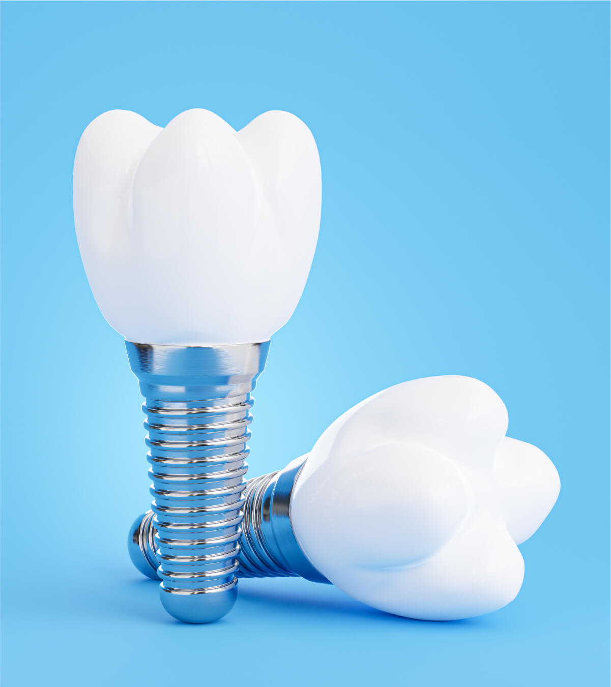 What Are Dental Crowns?